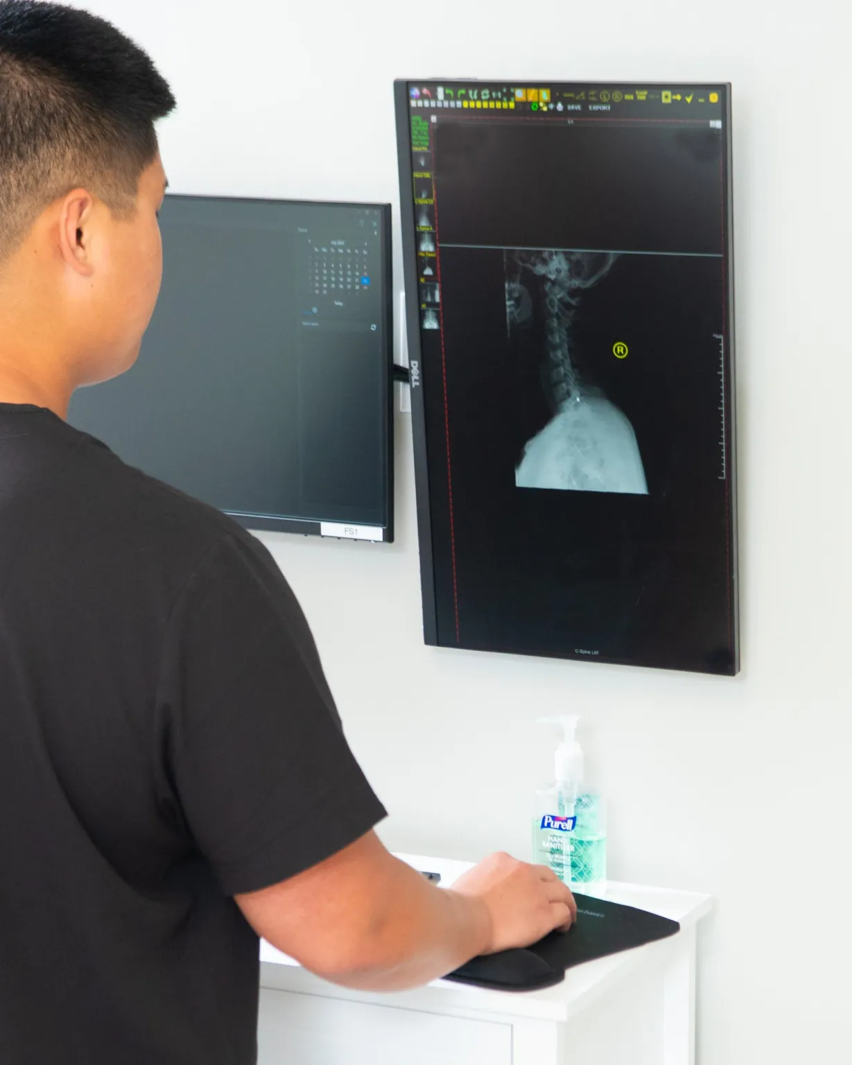 Discover Your Spinal Health with Advanced Digital X-Rays in Lenexa