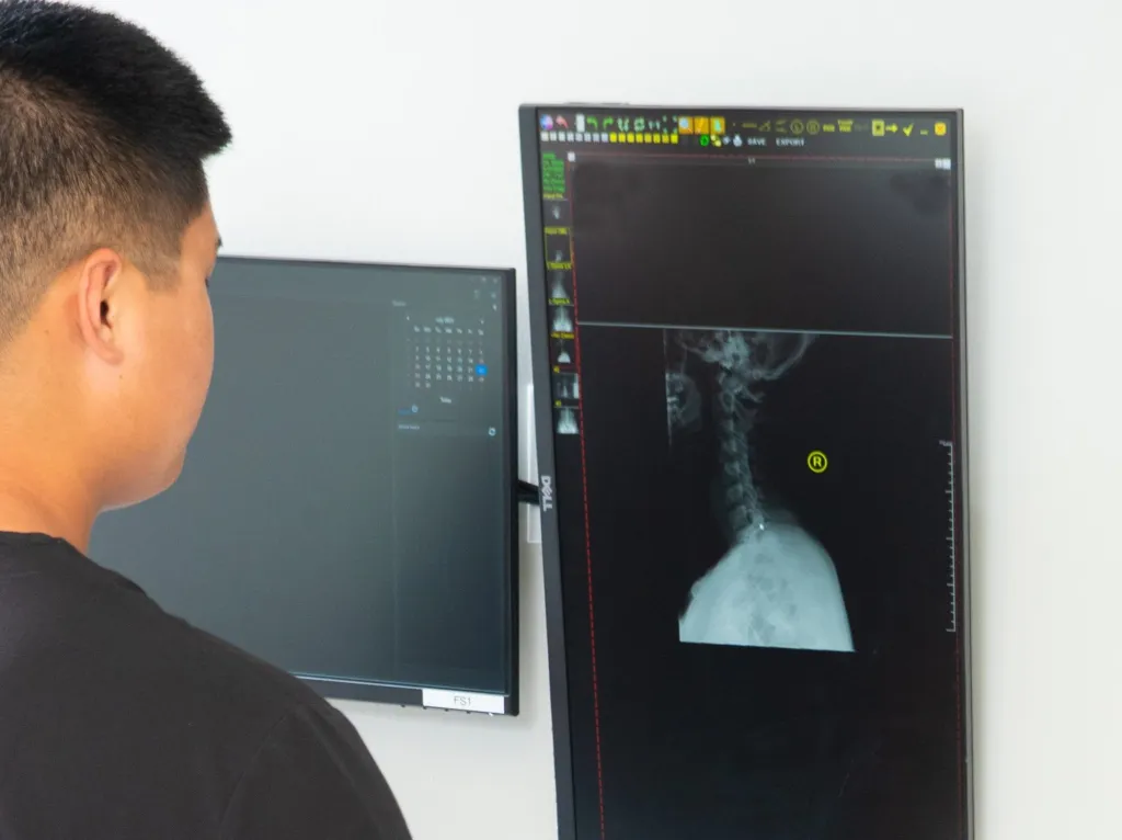 Dr. On viewing X-ray